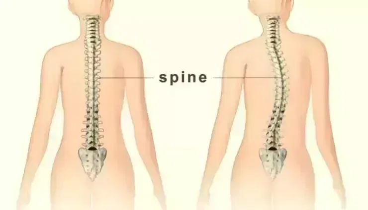 What is genotropin hgh? before taking Genotropin